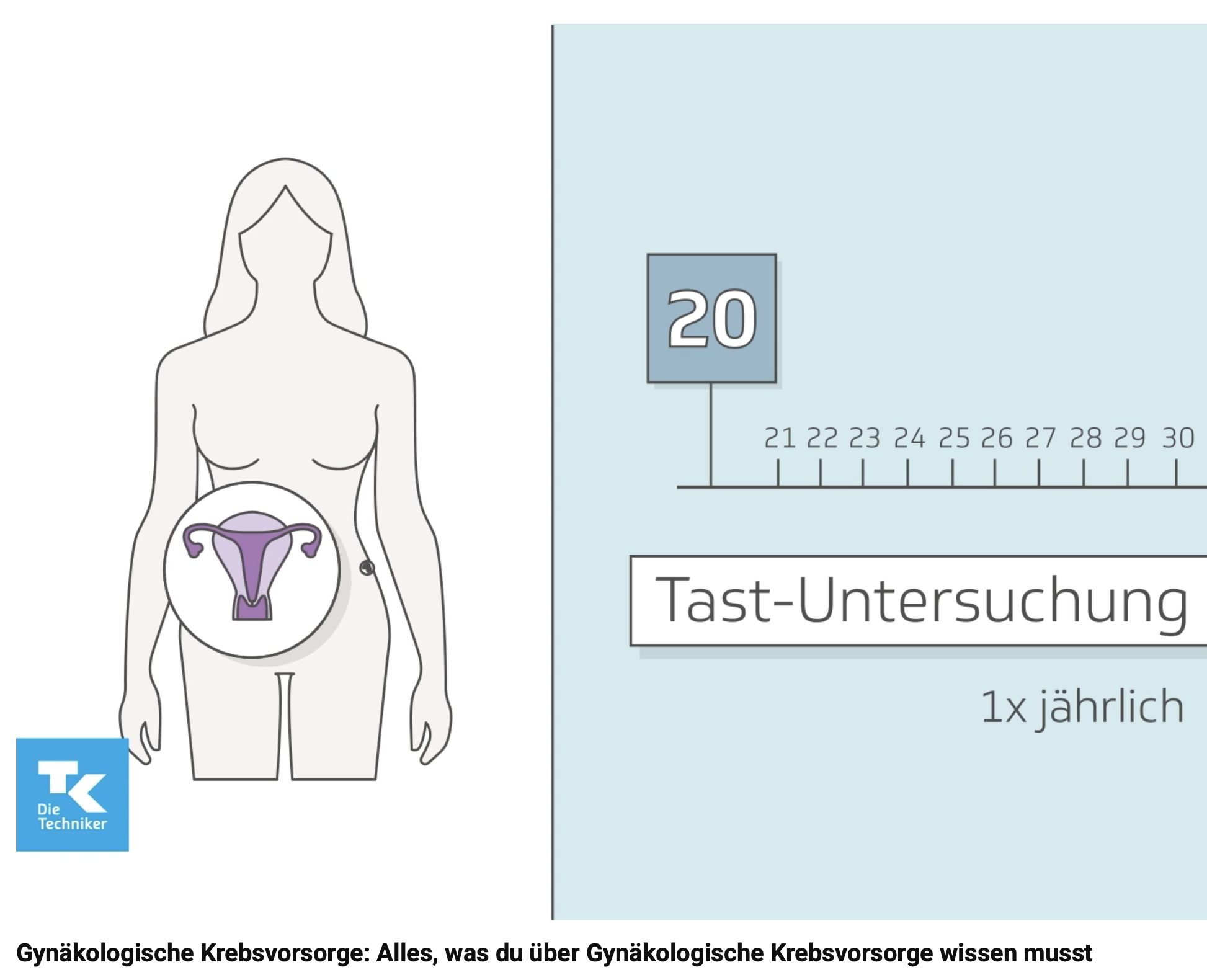 TK Erklärvideos - Themenverdichtung, Kreation Off-Text
